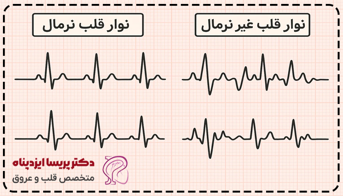 عکس نوار قلب سالم و ناسالم