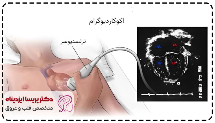 تفسیر اکو قلب
