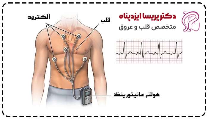 نتایج هولتر قلب