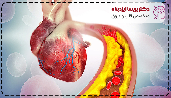 علت سکته قلبی