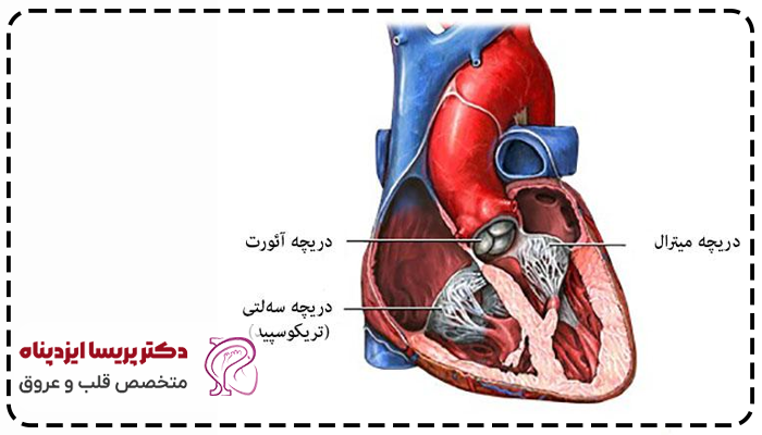 علائم تنگی دریچه آئورت