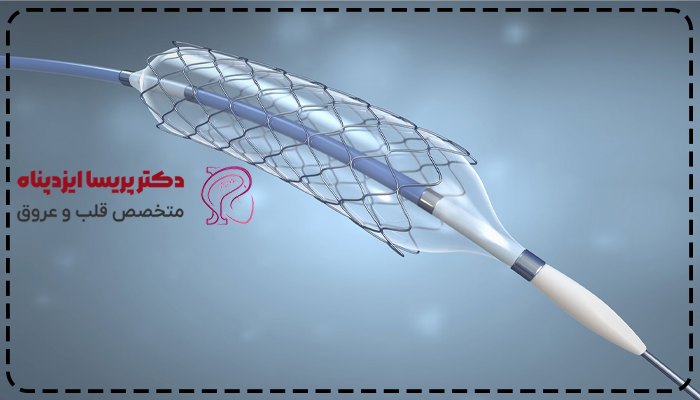 مقایسه بالن و فنر قلب