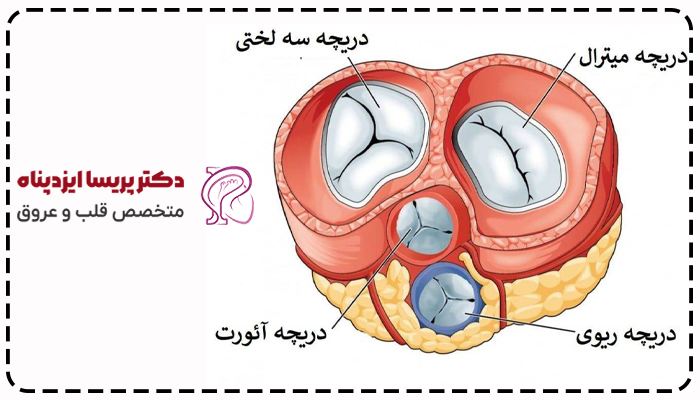 گشادی دریجه آئورت