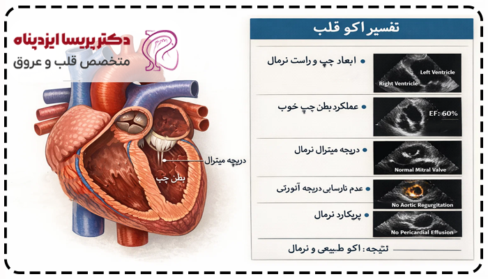 تفسیر اکو قلب