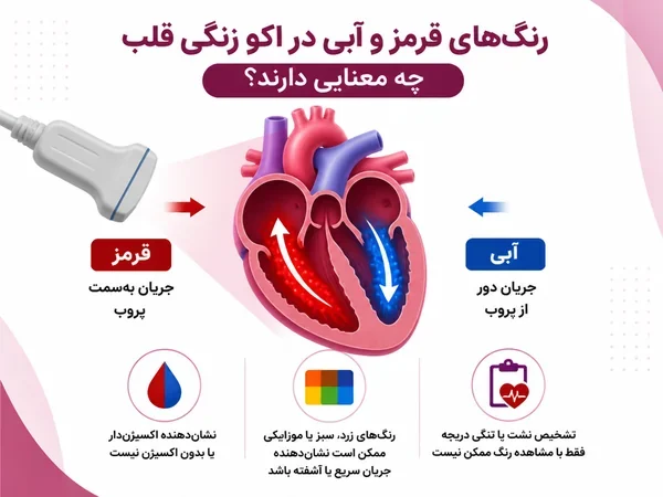 راهنمای رنگهای داپلر برای جهت جریان خون